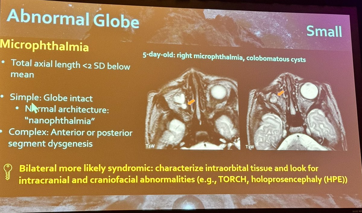 Our alumnus @@ashasarm now @VUMCradiology presents her excellent talk on orbital developmental abnormalities @The_ASPNR in San Diego.