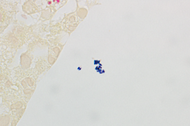 The Joint Pathology Center (JPC) tweet media