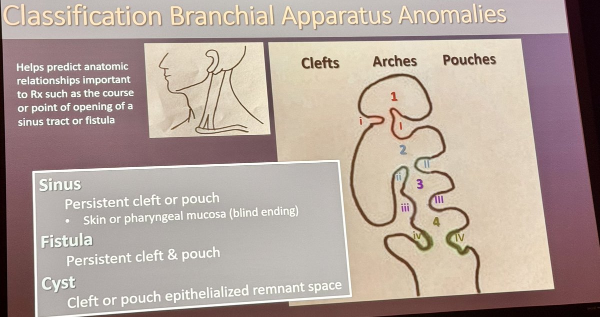 Next in the parade of our alumni presenting @The_ASPNR is the brilliant Jennifer Vaughn now at Phoenix Children’s Hospital expertly extolling imaging and embryological correlates of branchial cleft anomalies