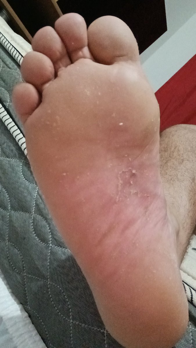 master_myst3ry's tweet photo. Are you ready? 🐷
#pigpay #cashmaster #feet_pic #paypiggieswanted https://t.co/QNXxgXv0iJ