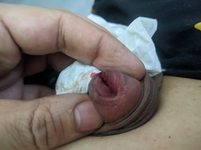 肉被我撕开了 #马眼 #尿道 https://t.co/eNB28LL06K<a href="/tag/%E9%A9%AC%E7%9C%BC"class="tags">#马眼</a><a href="/tag/%E5%B0%BF%E9%81%93"class="tags">#尿道</a>