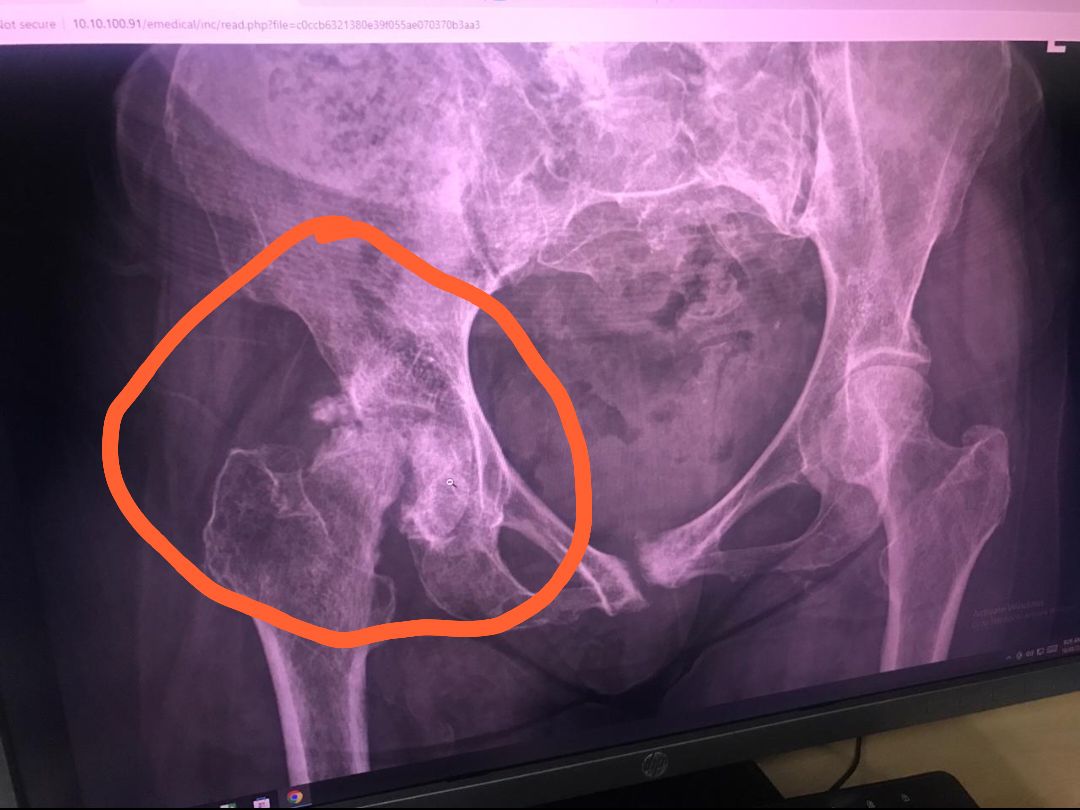 nyuki_malkia's tweet photo. Wadau wa X 
Naisogeza kwenu hii mama anaumwa hoi anahitajika operation na muhimbili wanataka milioni 12
Mwenye chochote tumsaidie https://t.co/8regnt3HaV