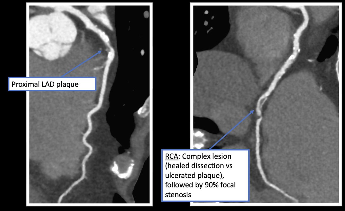 Umair Khalid tweet media