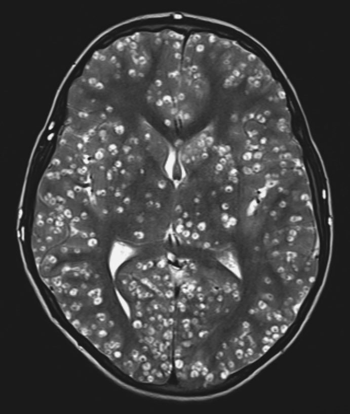 radRounds Radiology Network tweet media