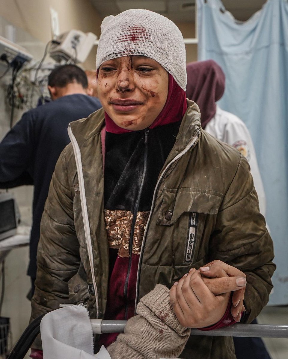 Girl holds the hand of her injured mother after they were injured in an Israeli bombing of a house to which they fled in the city of Khan Yunis.
