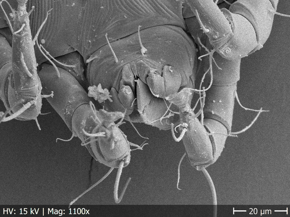 CarmenJavier_'s tweet photo. 🕷 Ácaro bocabajo captado al microscopio electrónico de barrido.

¡Nos vemos en los bares con el @pintofscienceES 2024 entre el 13 y 15 de mayo!  

#PINTacoteca #PINT24 #PINT24ES https://t.co/gzuN2Sjtl9