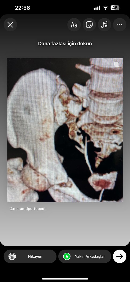 dr_haluk yaka tweet media