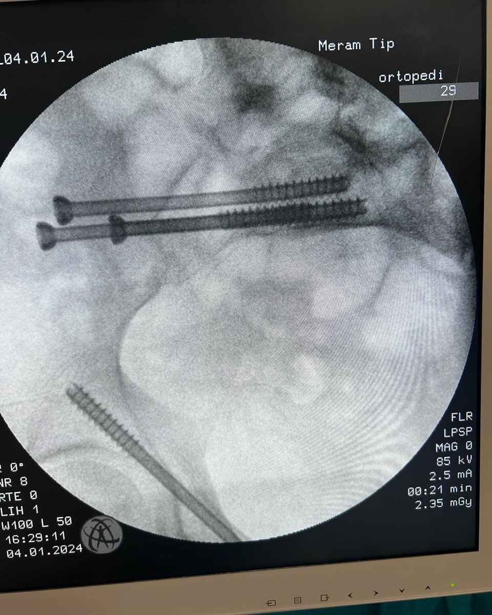 dr_haluk yaka tweet media