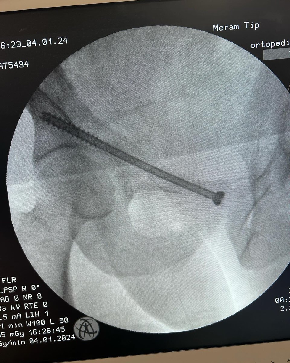 dr_haluk yaka tweet media