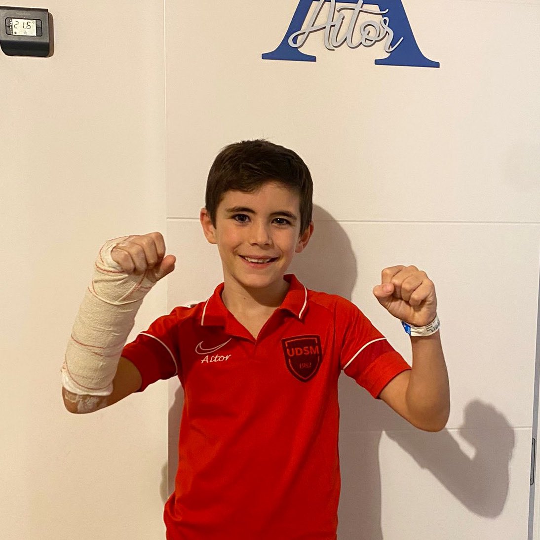 UDSantaMarta's tweet photo. 🔴⚪️ #AcademiaUDSM
Ahí lo tenemos, como un campeón‼️ Con una fractura de radio y como si nada, con toda la fuerza para volver a jugar cuanto antes. Mucho ánimo, Aitor 💪💪💪 En nada estarás de nuevo con tus compañeros del Benjamín A
#OrgulloUDSM https://t.co/6vgTF9OMz9