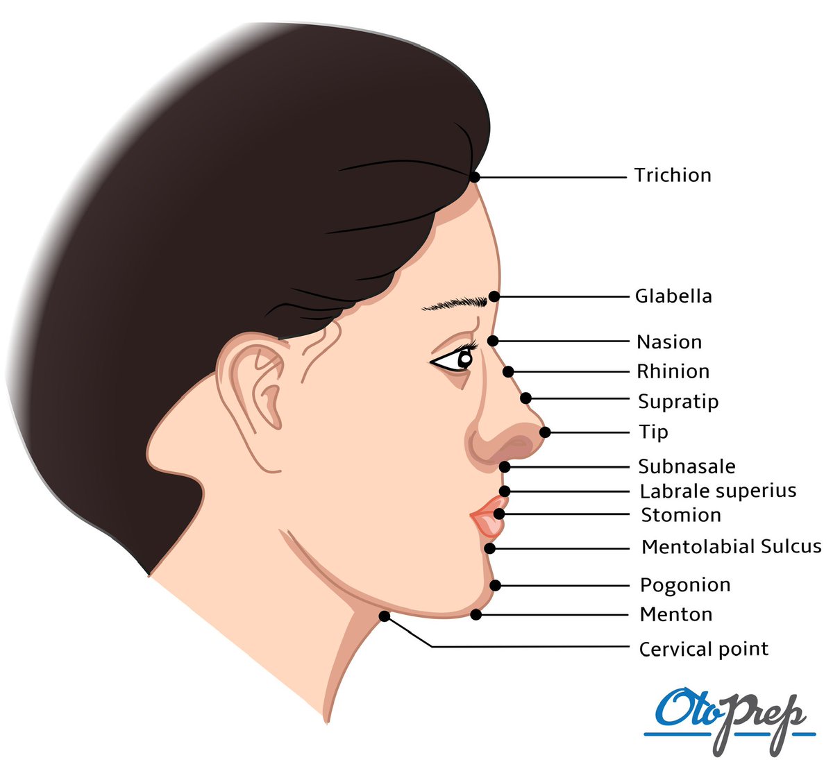 Explore facial landmarks with #OtoPrep! 🧐 Can you identify the nasion or pinpoint the thinnest skin on the nose? Essential for #FacialPlasticSurgery & #Otolaryngology exams.

#MedEd #Rhinoplasty #ENTeducation #SurgicalAnatomy #ENTResidents #Anatomy #MedX #Doctors