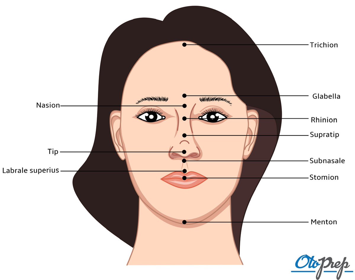 OtoPrep's tweet photo. Explore facial landmarks with #OtoPrep! 🧐 Can you identify the nasion or pinpoint the thinnest skin on the nose? Essential for #FacialPlasticSurgery &amp; #Otolaryngology exams.

#MedEd #Rhinoplasty #ENTeducation #SurgicalAnatomy #ENTResidents #Anatomy #MedX #Doctors https://t.co/dPtUjc8kYR