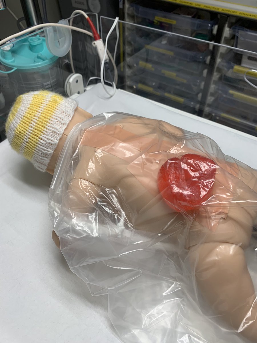 Antenatal Dx myelomeningocele - how does your team prepare? 
How would u protect this defect @ deliv?
Baby needs IPPV…do u consider defect whilst sorting A&amp;B? 
Moulage: <a href="/GilloneJenna/">Jenna Gillone</a> 
Seriously slick stabilisation: RVI NICU teams own 🔥🍩<a href="/NorNetUK/">NNN</a> 
#neodonut #neosim #neotwitter