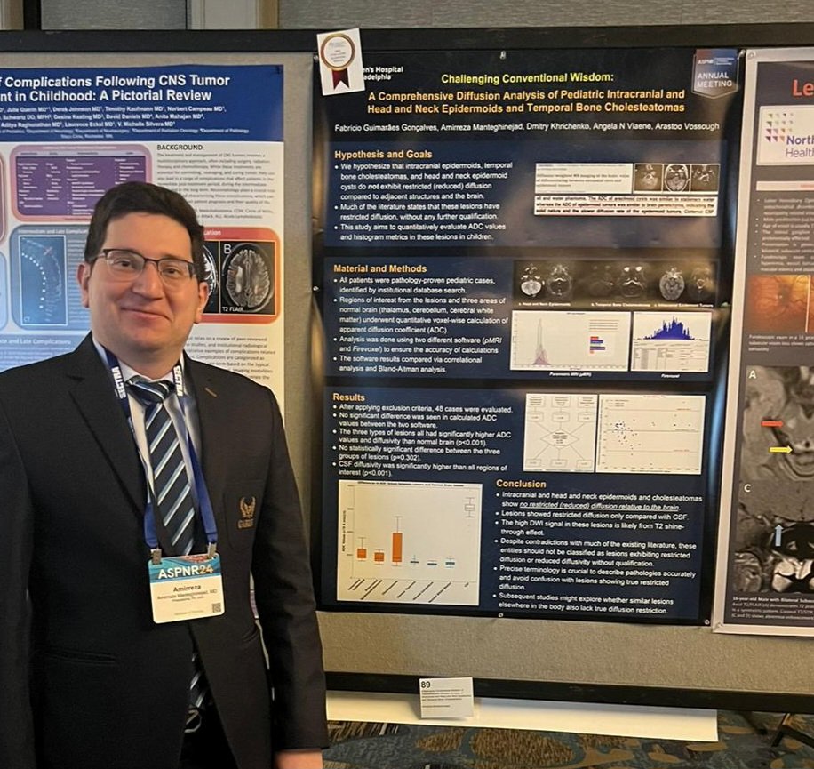 Amirreza Manteghinejad (@armanten) on Twitter photo Thrilled to announce our team's other achievement! 🌟 We've been honored with the Cum Laude Award for one of our poster presentations at <a href="/The_ASPNR/">American Society of Pediatric Neuroradiology</a> Thrilled to announce our team's other achievement! 🌟 We've been honored with the Cum Laude Award for one of our poster presentations at <a href="/The_ASPNR/">American Society of Pediatric Neuroradiology</a>
