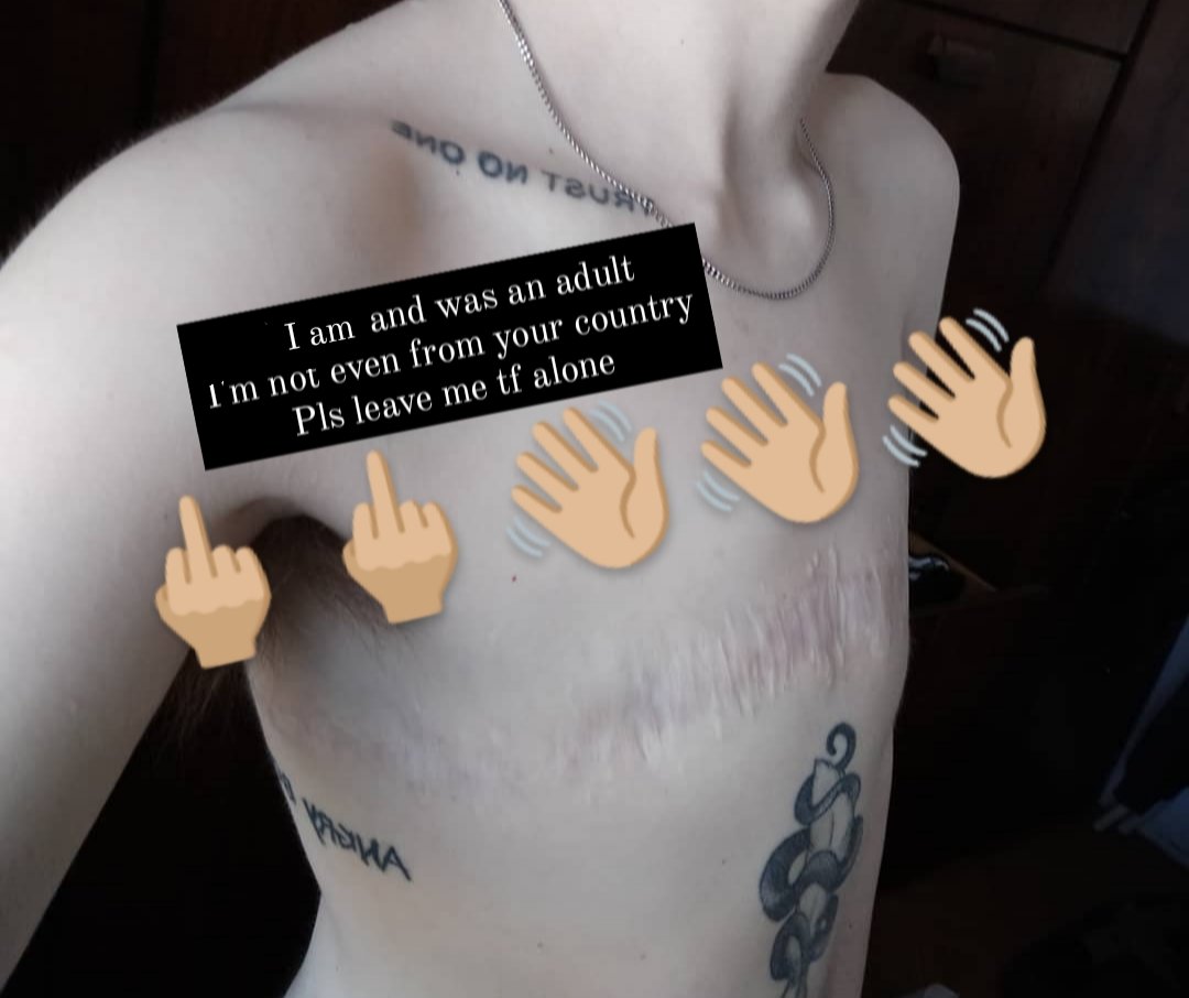 z4ckito13's tweet image. Congrats! You found me. This will be (hopefully) my only fckng tweet here.
1) No, i was not a minor when i had top surgery in 2017
2) Yes, it was top surgery, I'm not a cancer survivor
3) I'm not even from your country, can y'all just mind your business fgs???
