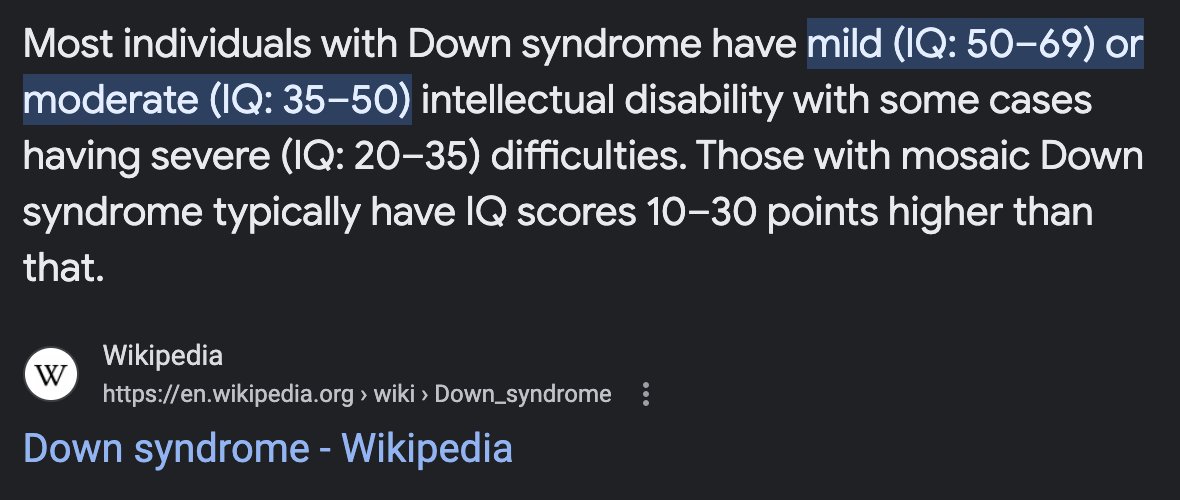 Down syndrome - Wikipedia