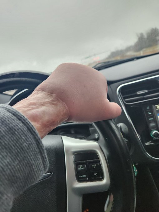 Imagine having a great date with a handsome guy and you see that arm💀