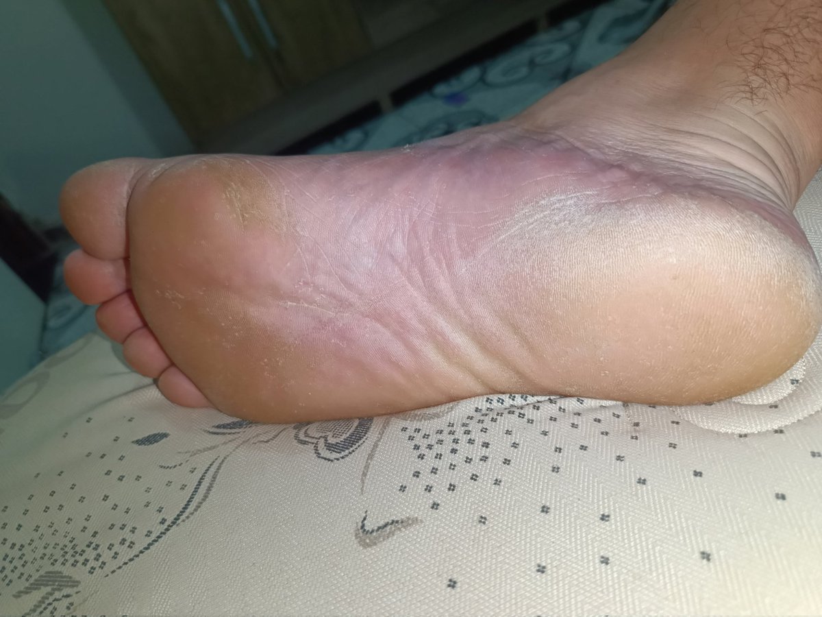 master_myst3ry's tweet photo. Meus pés estão cansados depois de um dia todo de trabalho! 

#findom #fandomfeet #feetpicsforsales https://t.co/VYuMiGEClF