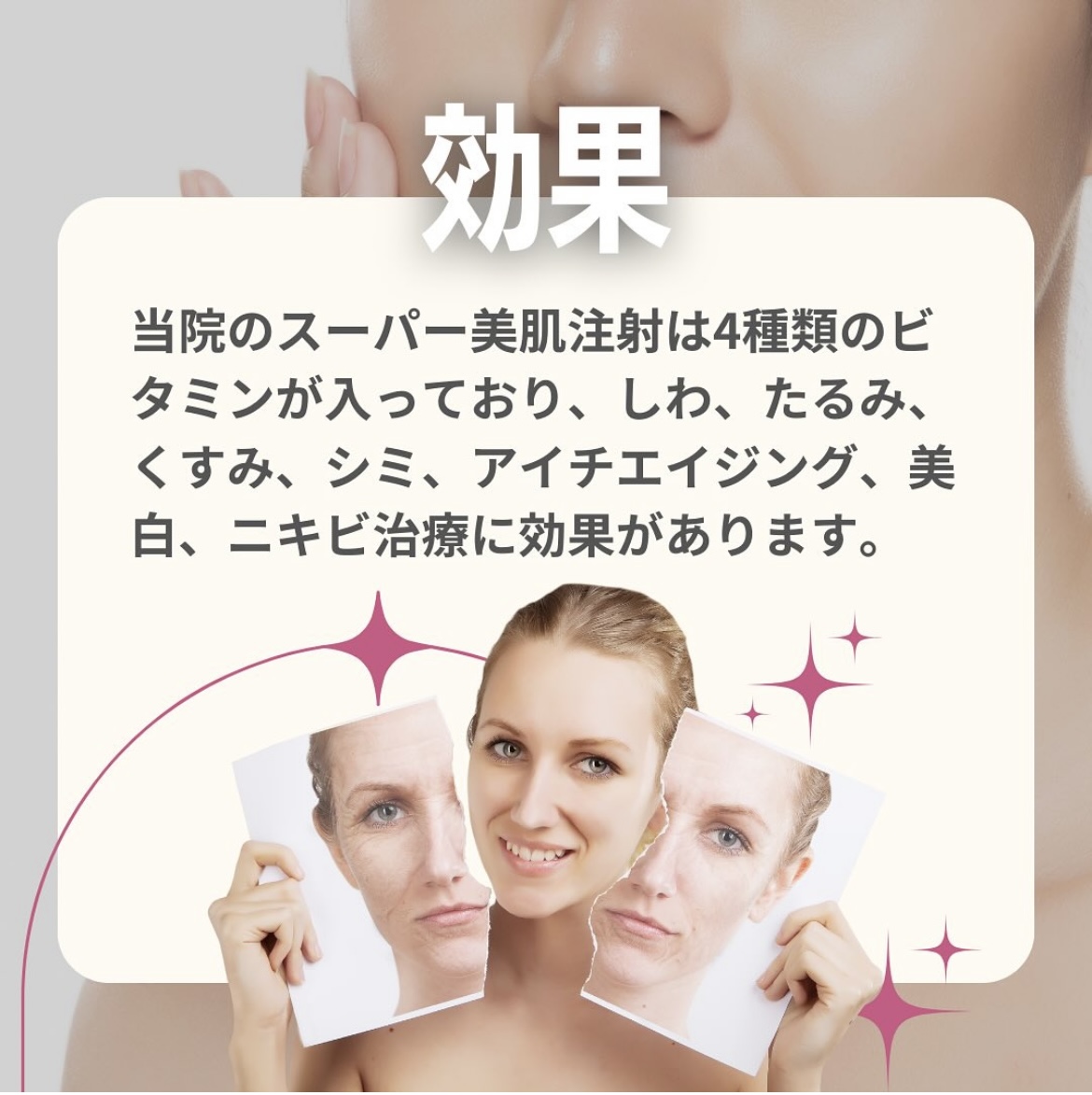 ClairClinic's tweet photo. シワやたるみにアプローチし、
若々しいお肌を手に入れませんか☺️✨

忘年会や新年会続きで肌荒れがあああぁぁ😱😱
なんて方にもオススメです💘

スーパー美肌注射　LINEお友達価格￥3,300💉✨
0800-800-9766☎️
＃美肌注射　＃美容注射　＃隙間時間　＃ビタミン https://t.co/0sO2t18Ki6