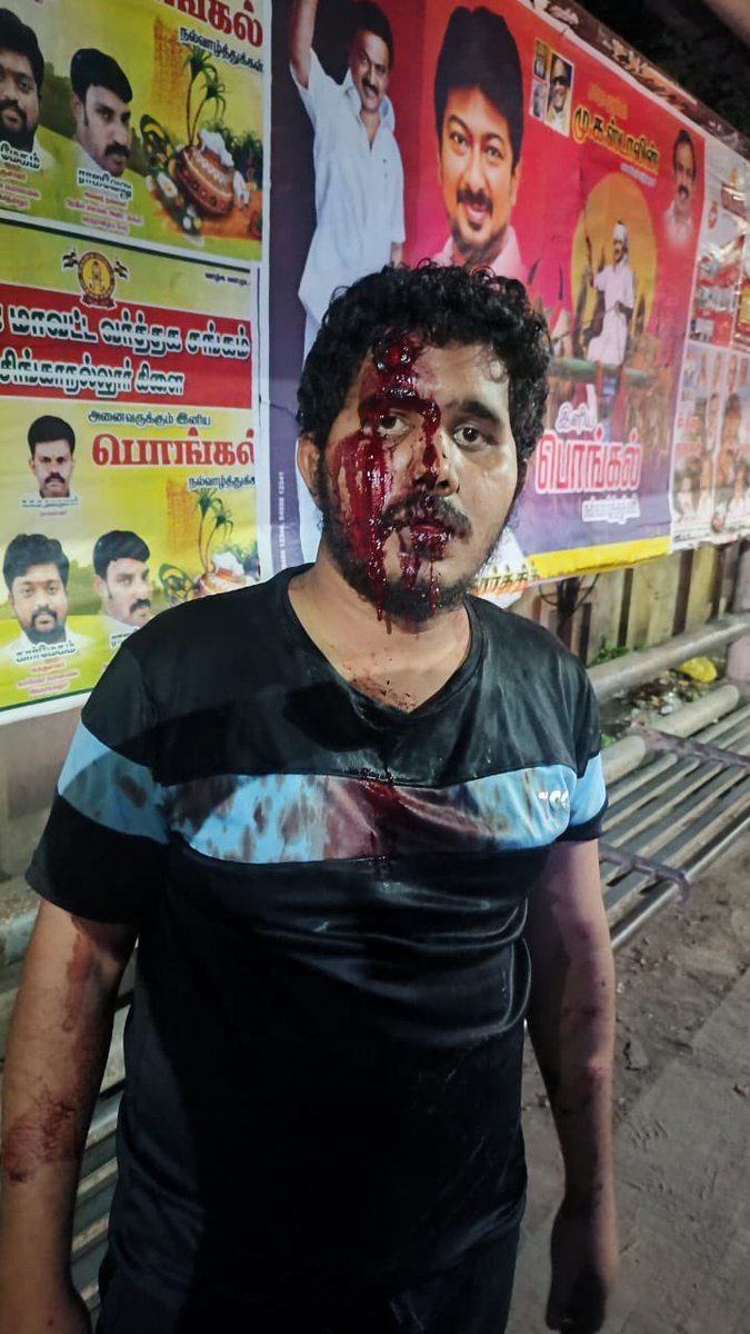 Saattaidurai's tweet photo. கோவை சிங்காநல்லூர் பகுதி நாம்தமிழர் கட்சியின் பொறுப்பாளர் ஆசிக் பொங்கல் வாழ்த்து சுவரொட்டி ஒட்டிக் கொண்டிருக்கும்போது கஞ்சா போதையில் இருந்த சமூக விரோதிகள் மது பொத்தல்களை வைத்து ஆசிக் மற்றும் அவருடன் சென்ற பாலாஜி என்பவரையும் தாக்கியுள்ளனர் !

உயிருக்கு ஆபத்தான நிலையில் தம்பி ஆசிக் மருத்துவமனையில் சிகிச்சை பெற்று வருகிறார் ,காவல்துறை இதுவரை எந்த நடவடிக்கையும் எடுக்கவில்லை ,கோவை மாநகராட்சிக்கு உட்பட்ட பகுதியில் கஞ்சா போதையில் உயிருக்கு ஆபத்து விளைவிக்கும் சமூக விரோத கும்பலை காவல்துறை உடனடியாக கைது செய்ய வேண்டும் !

@tnpoliceoffl