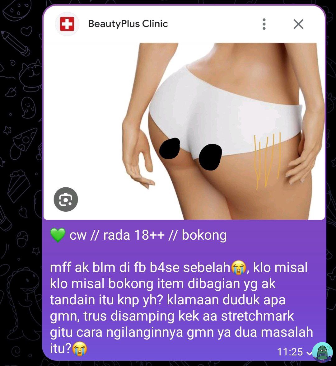 tanyakanrl's tweet image. 💚 cw //  p 4 n t 4 t

minimal lima kataa