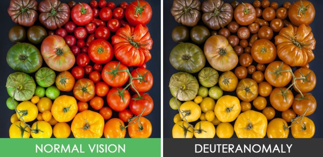 شاب ثلاثيني يعناني من مشكله الالون . و رسب في إختبار الرخصة مع فحص (اشيهارا ) 

مع عدسات كروماجين (اللون الوردي ) تمكن من إكمال فحص اشيهارا و اجتاز الاختبار .