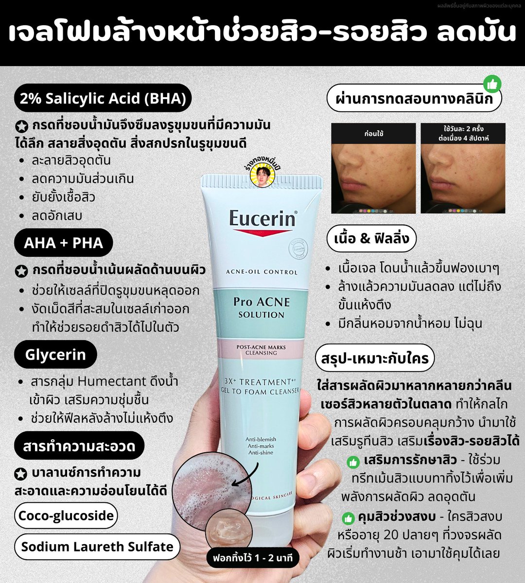 PaoRangThong's tweet photo. เจลโฟมล้างหน้าช่วยสิว-รอยสิว ลดมัน สูตรใหม่ Eucerin

- ส่วนผสมสิวจัดเต็ม 
- ช่วยรอยดำสิวในตัว
- ลดความมันส่วนเกิน
- ละลายการอุดตันในรูขุมขนด้วย BHA 2%
- งัดเซลล์ผิวที่หมักหมมออกด้วย AHA + PHA
- มี Glycerin เติมความชุ่มชื้น หลังล้างผิวไม่แห้งตึง

ใช้เสริมในรูทีนสิวได้ดี

/🧵สอนใช้ https://t.co/Li4gXX8RCZ