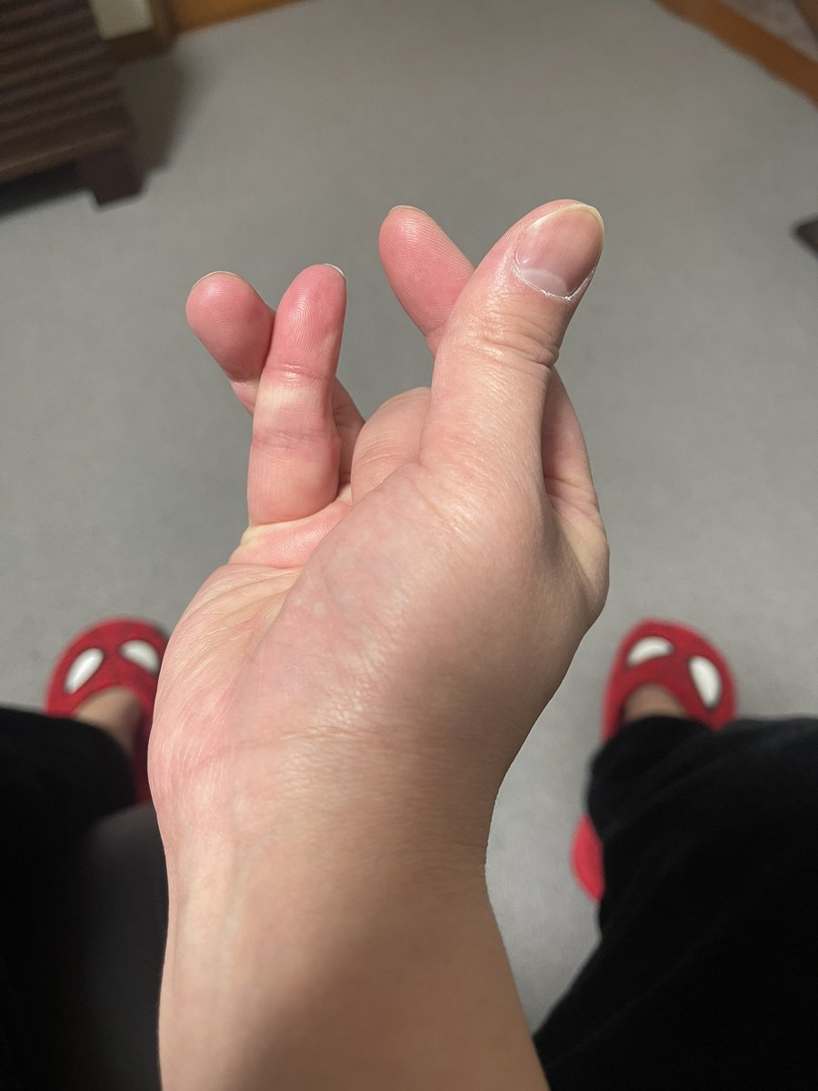 the_Vambi's tweet photo. 驚かないで聞いて欲しいです

片手でハートが２つ作れる方法を発明しました！

推し活などにご利用下さい。 https://t.co/1KlnSICdep