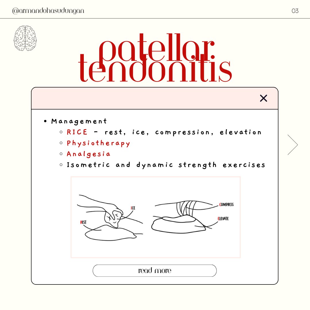 armandohasudung's tweet photo. Patellar tendonitis is inflammation and pain over the patella tendon. It commonly arises from jumping sports such as volleyball and basketball.
Watch the full video here: https://t.co/HEW0w72ezg
.
.
.
#Armando #patellartendonitis #patella #tendonitis #medicalnotes https://t.co/Flkbp6pZVI