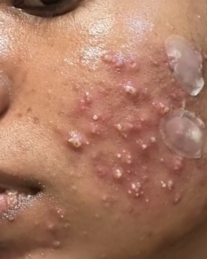 WVGIF's tweet image. ‘Saya dah buat laporan dekat KKM, dah bagi semua bukti yang kukuh, tapi saya tak tahu KKM tengah buat apa’ - Rajeswary

I ada soalan untuk beauty obsessed ladies yang tengah baca ni: Engkorang semua tak ada common sense nak check background produk SEBELUM beli ke? 😑