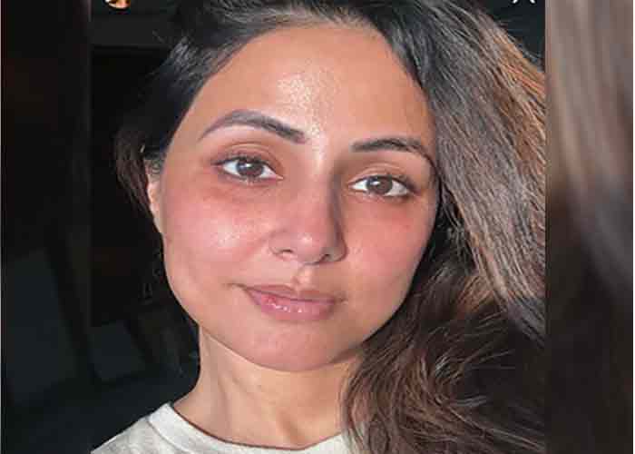 yespunjab's tweet photo. Hina Khan shares raw no-filter selfie with red rashes, blisters on lips
#HinaKhan #Bollywood #NoFilter #Seflie #redrashes #Blister #Lips #Bollywood #BollywoodActresses #YesPunjab
@eyehinakhan
https://t.co/tI7bhG1kE2 https://t.co/PIMjaPqYph