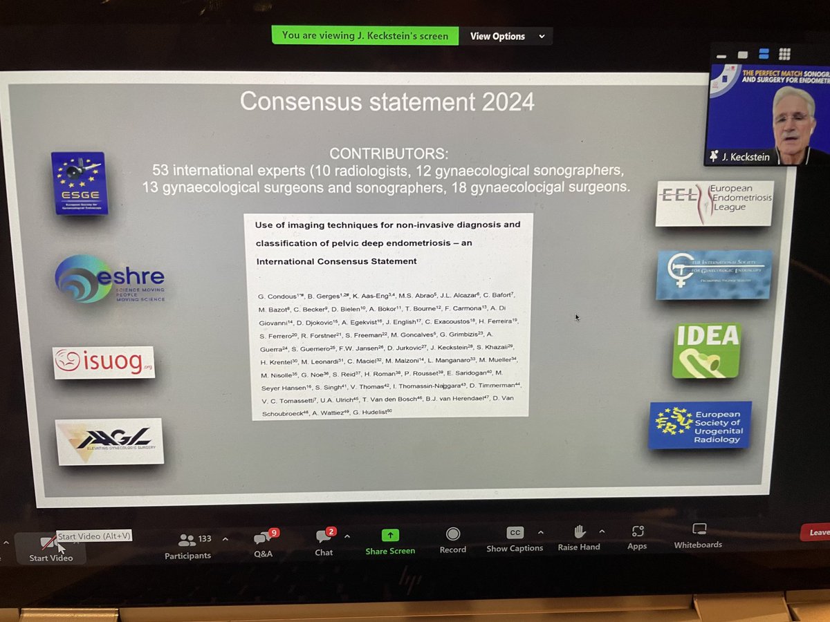 Professor George Condous (@georgecondous) on Twitter photo Joerg Keckstein speaks about Endometriosis Intersociety Consensus <a href="/ESGEorg/">European Society of Gynaecological Endoscopy</a> <a href="/ISUOG/">ISUOG</a> <a href="/EuroEndoLeague/">European Endometriosis League</a> Joerg Keckstein speaks about Endometriosis Intersociety Consensus <a href="/ESGEorg/">European Society of Gynaecological Endoscopy</a> <a href="/ISUOG/">ISUOG</a> <a href="/EuroEndoLeague/">European Endometriosis League</a>