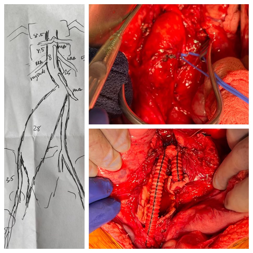 UTSWVascular tweet media