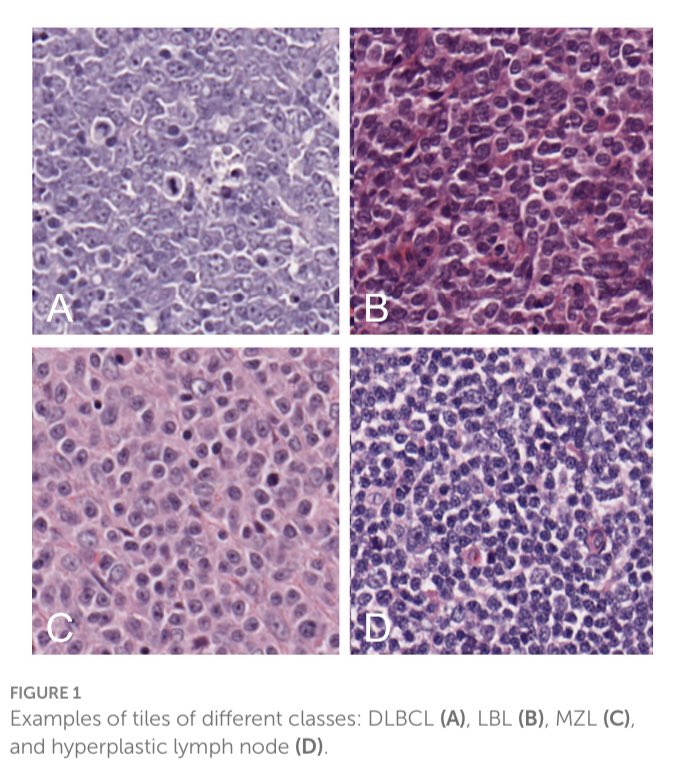 Our recent publication exploring the application of AI to Lymphoma diagnosis in dogs. Congratulations to Magdalena our Vet Student
