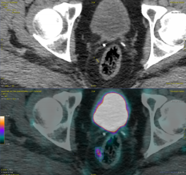 Carmelo Tuscano🇮🇹🇪🇺 tweet media