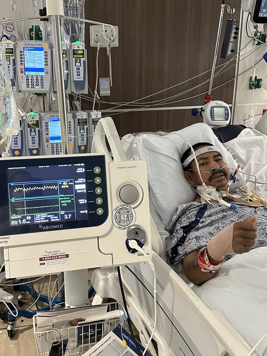 Gaston A. Cudemus, MD (@gcudemusmd) on Twitter photo A dream becomes a goal when action is taken toward its achievement. Sharing our first successful #RPflex #Impella @Abiomed implantation for severe RV failure <a href="/NCHRooneyHeart/">NCH Rooney Heart Institute</a> and first in #SWFL #MCS <a href="/DrBrianSolomon/">Brian Solomon</a> <a href="/md_viviana/">Viviana Navas, MD</a> <a href="/Martinez_RuizMD/">Ricardo Martinez-Ruiz</a> <a href="/RCubedduMD/">Roberto J. Cubeddu, MD</a> <a href="/LuisHPazMD/">Luis H. Paz Rios, MD</a> A dream becomes a goal when action is taken toward its achievement. Sharing our first successful #RPflex #Impella @Abiomed implantation for severe RV failure <a href="/NCHRooneyHeart/">NCH Rooney Heart Institute</a> and first in #SWFL #MCS <a href="/DrBrianSolomon/">Brian Solomon</a> <a href="/md_viviana/">Viviana Navas, MD</a> <a href="/Martinez_RuizMD/">Ricardo Martinez-Ruiz</a> <a href="/RCubedduMD/">Roberto J. Cubeddu, MD</a> <a href="/LuisHPazMD/">Luis H. Paz Rios, MD</a>