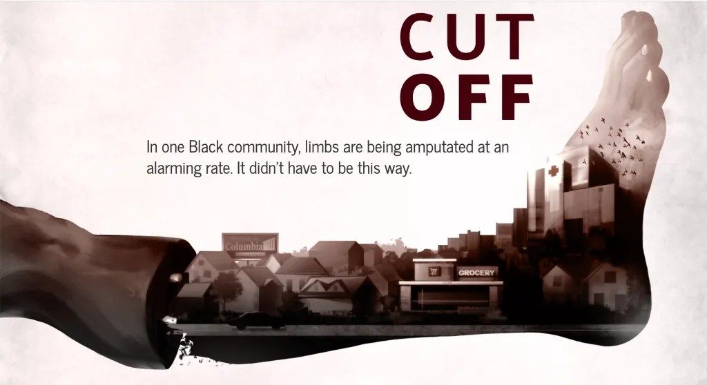 David G. Armstrong follow @dgarmstrong.bsky.social (@dgarmstrong) on Twitter photo Cut Off: The Impact of Amputation in One Black Community @TheState @ALPSLimb <a href="/VascularSVS/">Vascular SVS</a> <a href="/VascularCures/">Foundation to Advance Vascular Cures</a> <a href="/APMA/">APMA</a> – DF Blog diabeticfootonline.com/2022/03/28/cut… Cut Off: The Impact of Amputation in One Black Community @TheState @ALPSLimb <a href="/VascularSVS/">Vascular SVS</a> <a href="/VascularCures/">Foundation to Advance Vascular Cures</a> <a href="/APMA/">APMA</a> – DF Blog diabeticfootonline.com/2022/03/28/cut…