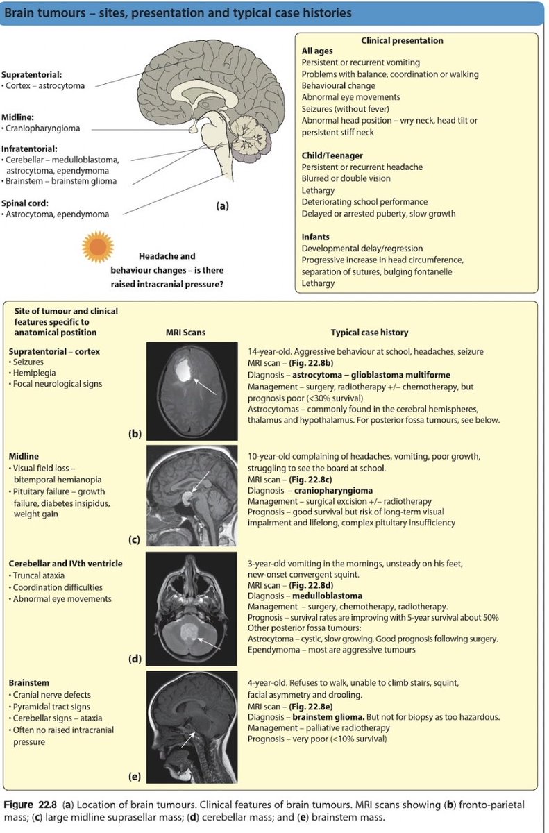 Pediatric brain tumors. Source unknown to me