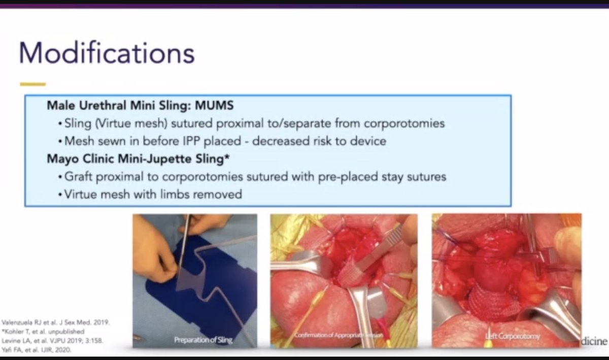 During @UCI_Urology Advanced International #MensHealth Course, @MarahHehemannMD from @uwurology mentioned about a new male sling for minimal to moderate #incontinence and #climacturia, introduced by @faysal_a_yafi and @SKWilson10 et al. 👉 rdcu.be/dw412