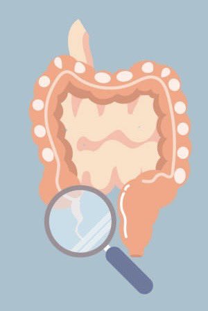 SurgJournal's tweet photo. Is nonoperative management of appendicitis safe and effective in multi-morbid patients?

https://t.co/8dDx6e4AQa

@UWEndoSurg @benzarzaur 
@SWexner @SyedAAhmad5 @juliomayol @debby_keller @pferrada1 @nlavellaneda @jnahmias1 @CPark_MD @GianlucaPellino 

#SoMe4Surgery https://t.co/LKrlNxzwni