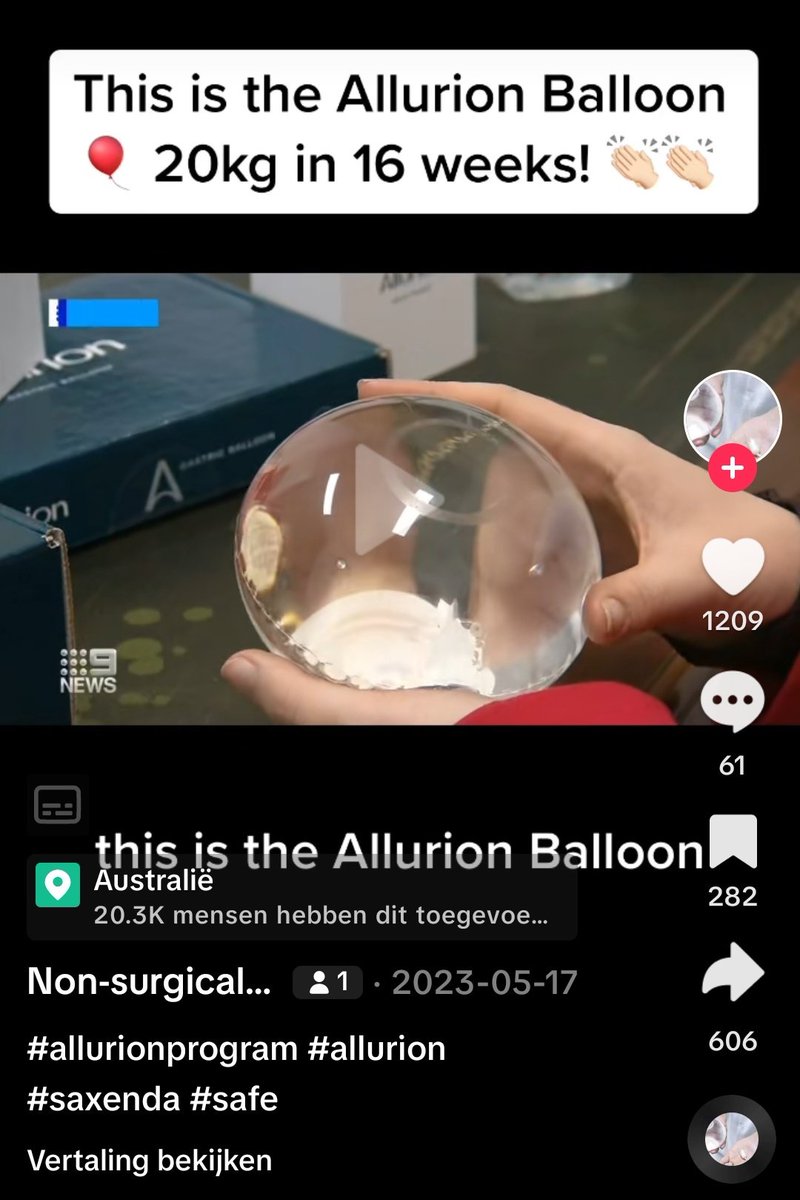 I just found out about the allurion balloon & I want it so bad.
No surgery nothing, you have to swallow a capsule with water. Then they check with an xray for the position. Then they fill it with water. After a while you poop it out & you're 10-20kg lighter

3rd pic different vid