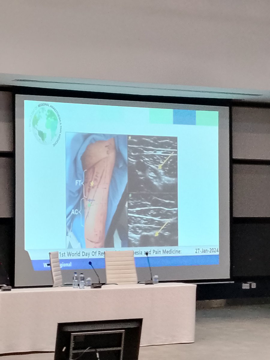 @Sonia_Lalla For adductor canal block, block in lower femoral triangle before branching to achieve extensive coverage.