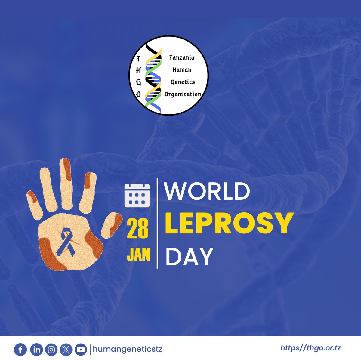 📢 Beat Leprosy! #WorldLeprosyDay

It is time to accelerate activities and redouble our efforts to work for a leprosy-free world 🌎

Join us today in spreading awareness, eliminating the stigma and advocating for the dignity of those affected by #leprosy

#WorldLeprosyDay
