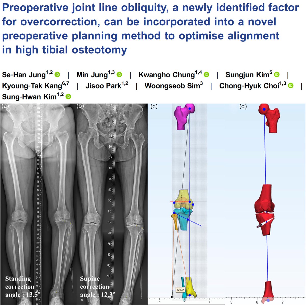 KSSTA's tweet photo. https://t.co/4TYjTPY1uH
Read this recently published study to get new insights into preoperative planning of HTO.
#knee #osteotomy #osteoarthritis #hto #dfo #dlo #jointline #alignment https://t.co/oPhJk6vJeQ