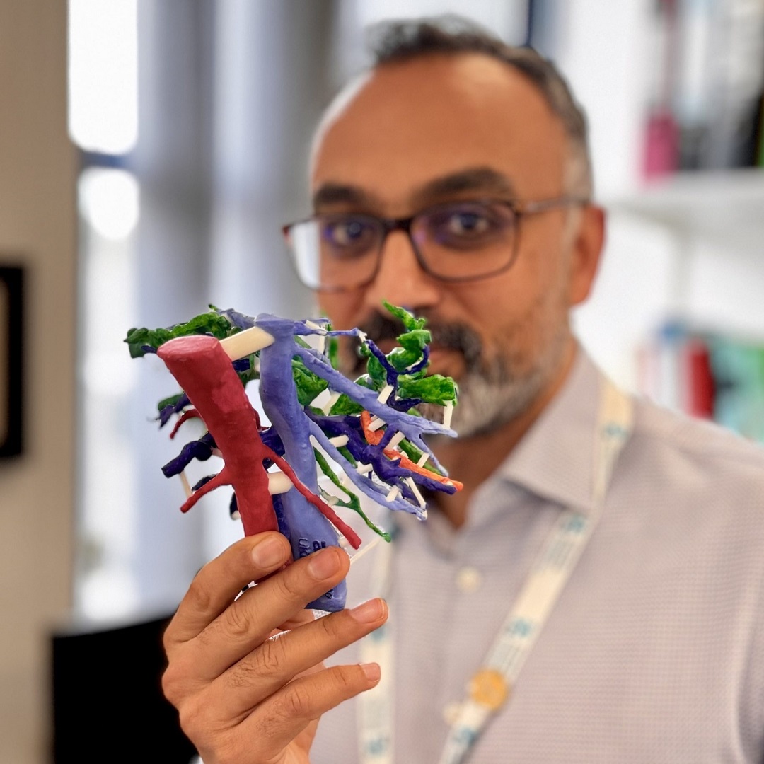 Can you guess what this is? 🔎 Surgeons in #Southampton are the first in the UK to trial using 3D printed livers to treat bile duct cancer. 🏥 The study is led by @UHSFT’s Arjun Takhar and supported by @PLANETSCHARITY. Read more: research.uhs.nhs.uk/news/3d-printe…