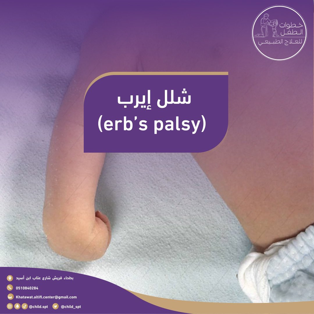 child_spt's tweet photo. ماهو #شلل_إيرب ؟ https://t.co/qVpBnAGrw8
