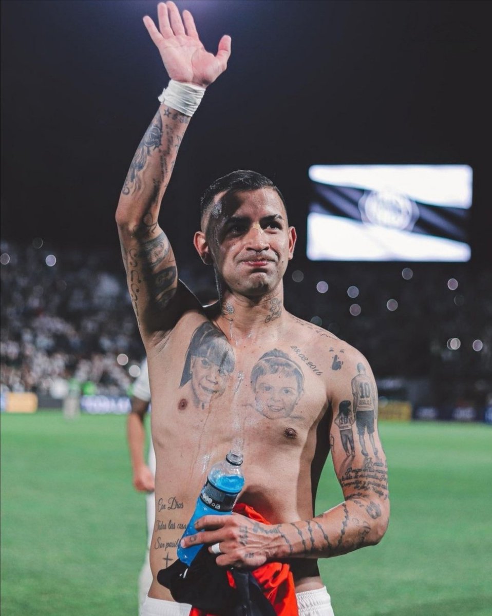Cuánta memoria corta!!
 Te veremos volver Derlis, te voy a bancar una y mil veces más.❤