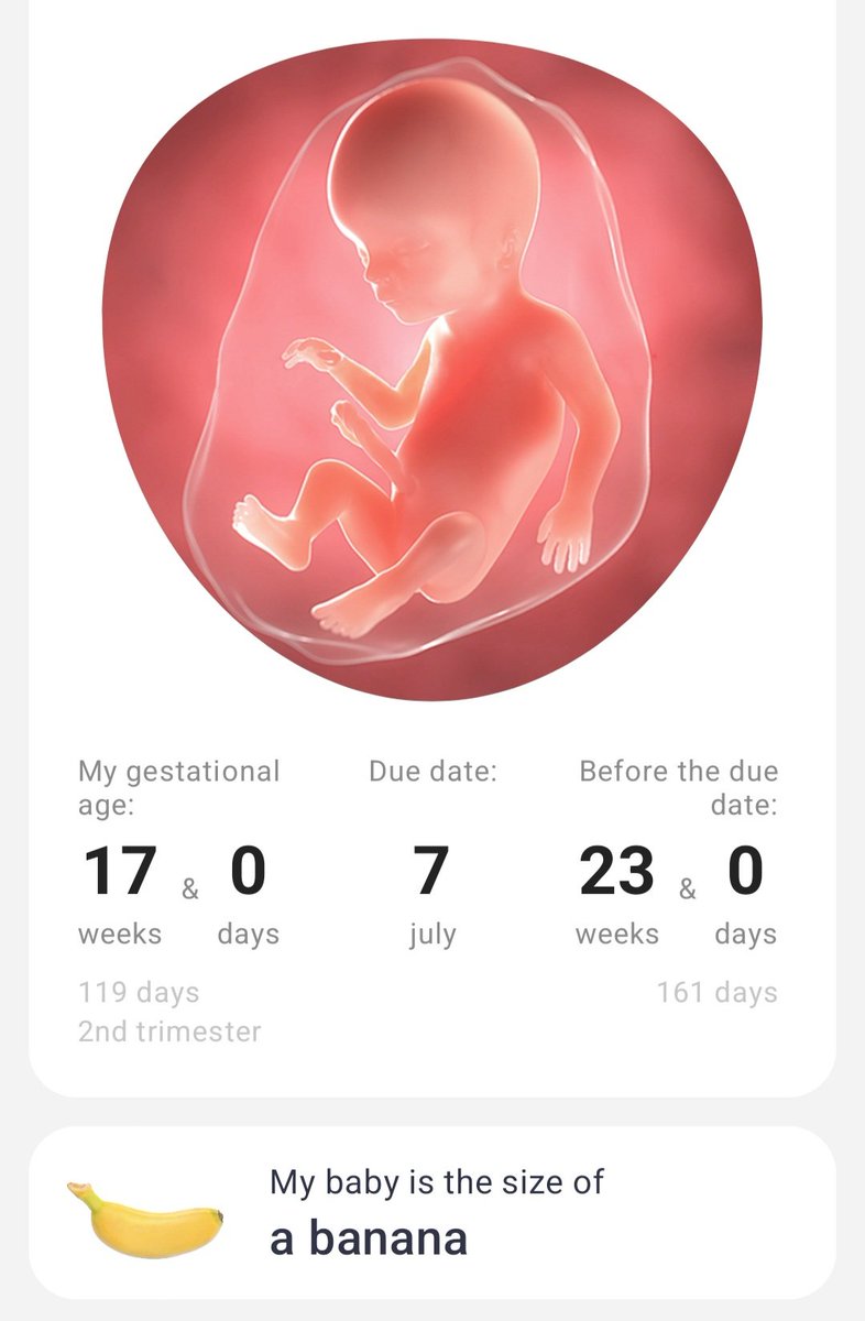 cass_reyy's tweet photo. I love my my banana! 😂🍌

17 weeks today🫶🏽

Registry link:

https://t.co/beMApMJ0my https://t.co/LK6mvm1lnn