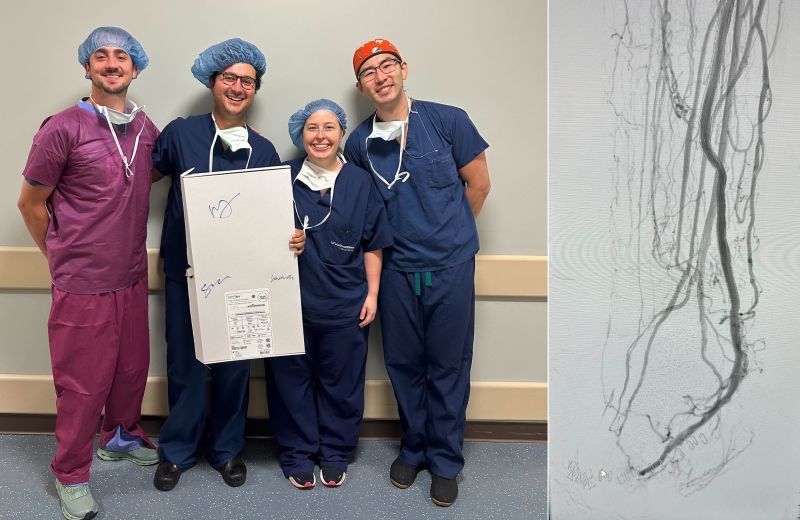 Throwback and big congratulations to our very own Dr. Michael Siah (second from left) and fellows Drs. Jackie Babb and Michael Zhang (to his right) for achieving the first commercial LimFlow TADV procedure in the USA #vascsurg #limbsalvage  #CLTI #amputation #PAD #UTSW