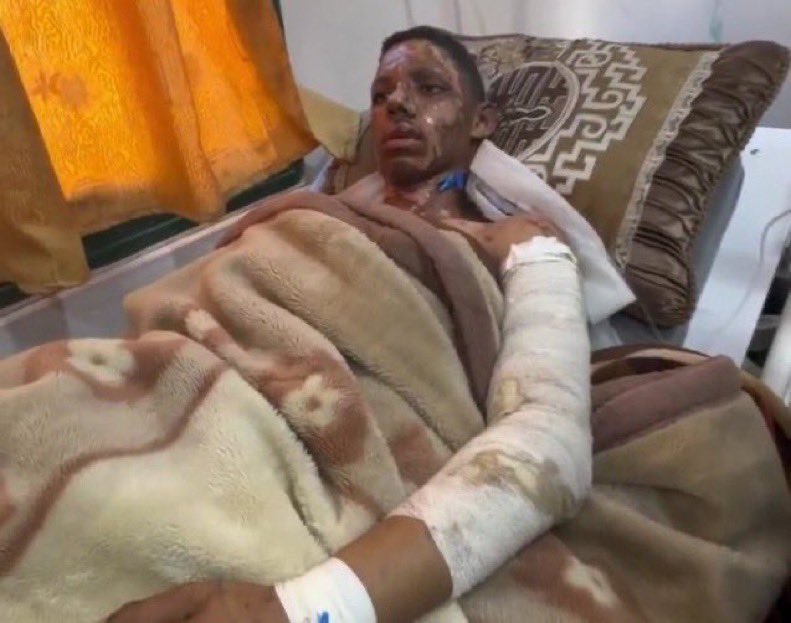 InsiderWorld_1's tweet photo. 🚨 Amro’s picture before and after his family home was bombarded. We are all responsible.

If Amr does not leave the crossing tomorrow, his hand will be amputated!!
Spread the hashtag in any way and contact whoever you can to help

#علاج_عمرو_ابو_قاسم
#علاج_عمرو_ابو_قاسم https://t.co/B4Ij5VeSLF